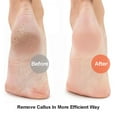 thumbnail image 6 of 4PCS Natural Pumice Stone, Fulanzaren Lava Pedicure Tools Hard Skin Callus Remover for Feet and Hands - Foot File Exfoliation to Remove Dead Skin, and Callusess, 6 of 7