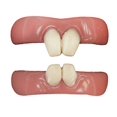 thumbnail image 1 of Tinsley Transfers FX Vermin Dientes postizos (2 piezas) Blanco / Rosa TT-TH403 Tinsley Transfers 813722020191, 1 of 1