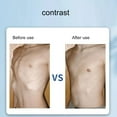 thumbnail image 4 of Cinturón de costilla rota elasticidad cómoda carpeta de pecho de costilla rota que reduce el dolor Tela compuesta para fractura ANGGREK Otros, 4 of 8