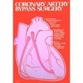 thumbnail image 2 of National Institutes of Health 18x24 Black Ornate Framed Double Matted Museum Art Print Titled: Coronary Artery Bypass Surgery (1980), 2 of 5