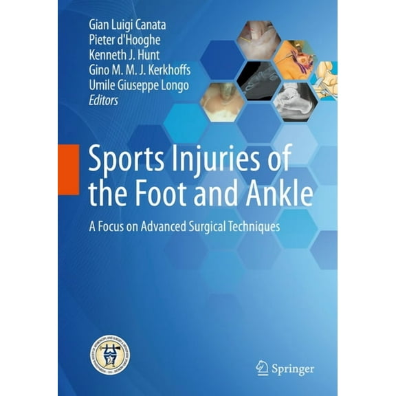 Sports Injuries of the Foot and Ankle: A Focus on Advanced Surgical Techniques, (Hardcover)