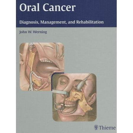 UPC: 9781588903099 | Oral Cancer : Diagnosis  Management  and Rehabilitation (Hardcover)