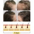 thumbnail image 5 of Ginger Shampoo Soap, Hair Growth Shampoo, Solid Shampoo Soap, Hair Growth Shampoo, 1pc--, 5 of 5