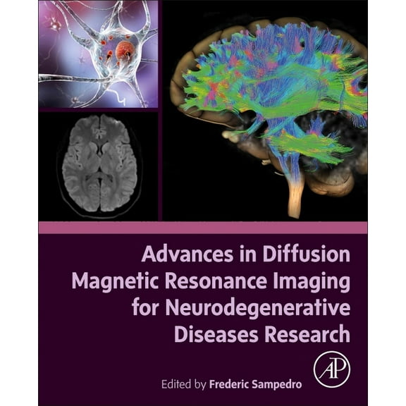 Advances in Diffusion Magnetic Resonance Imaging for Neurodegenerative Diseases Research, (Paperback)