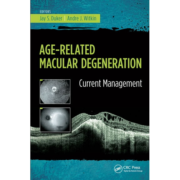 Age-Related Macular Degeneration: Current Management, (Paperback)