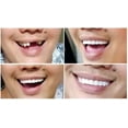 thumbnail image 3 of Instant Smile Comfort Fit Flex - Bright Shade - Upper Veneer Cosmetic Teeth, 3 of 4