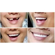 Instant Smile Comfort Fit Flex - Bright Shade - Upper Veneer Cosmetic Teeth
