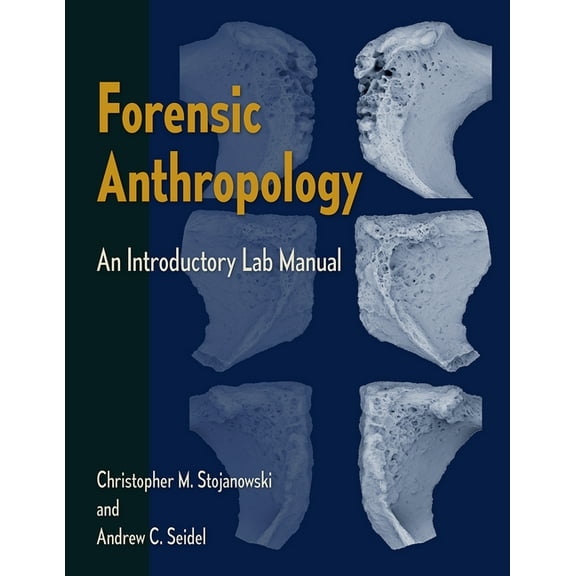 Forensic Anthropology: An Introductory Lab Manual, (Paperback)