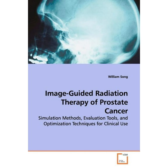 Image-Guided Radiation Therapy of Prostate Cancer (Paperback)