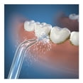 thumbnail image 3 of Cabezal para Irrigador Bucal Waterpik Clásica de Alta Presión JT-450E, 3 of 3