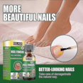 thumbnail image 1 of Toenails Tea Tree Oil Fungal Treatment -, 1 of 5