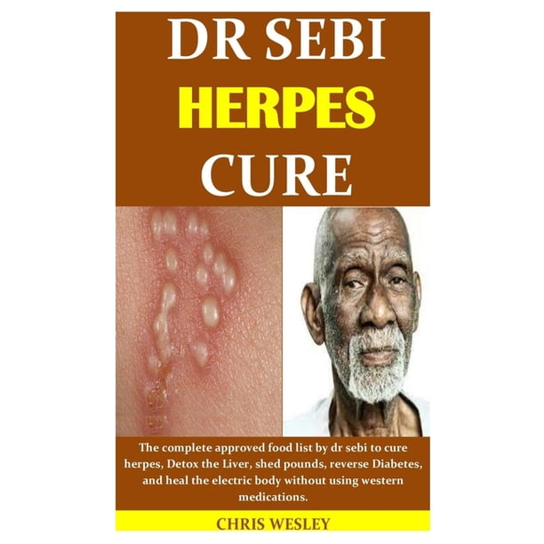 Dr Sebi Herpes Cure The Complete Approved Food List By Dr Sebi To Cure Herpes Detox The Liver Shed Pounds Reverse Diabetes And Heal The Electric Body Without Using Western Medications Dr Sebi Herpes Cure The Complete Approved Food List By Dr Sebi To Cure Herpes Detox The Liver Shed Pounds Reverse Diabetes And Heal The Electric Body Without Using Western Medications