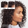 thumbnail image 4 of Champú Nioxin Hair Fall Defense activa los folículos pilosos 240 ml, 4 of 6