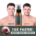 thumbnail image 3 of 2X Natural Men Beard Growth Roller Kit Men's Beard Growth Oil Nourishing Enhancer Beard Oil Spray Anti Hair Loss With Beard Roller new, 3 of 5