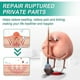 thumbnail image 5 of Body Care Hemorrhoid Cream,Relieves Anal Itching, Pain And Discomfort, Eliminates Hemorrhoids And Meat Balls, 5 of 5