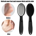 thumbnail image 2 of Kit de Pedicura Lima de Pies, Elimina Piel Muerta, Depurador de Pies de Pedicura, ABS Acero Inoxidable 304 TPR, Negro, 2 of 8