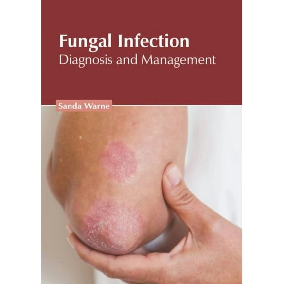 Fungal Infection: Diagnosis and Management (Hardcover)
