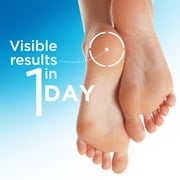 Flexitol Heel Balm, Cracked Heel Cream & Foot Balm, Intensive Hydration for Dry, Rough Feet & Heels, Urea-Based Moisturizing Cream, 2 oz Tube