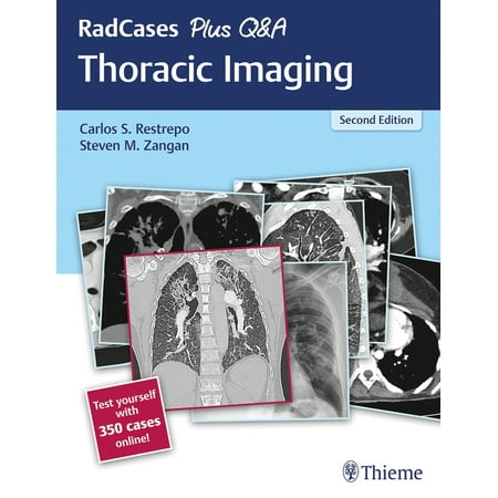 UPC: 9781626238145 | Radcases Plus Q&A: Radcases Plus Q&A Thoracic Imaging (Edition 2) (Paperback)