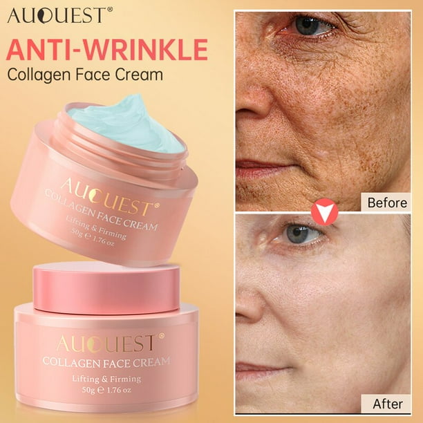 Crema blanqueadora Facial China Astragalus, elimina pecas, manchas oscuras, ilumina, hidrata, antienvejecimiento, cuidado de la piel Facial"1Pcs" Fivean LED
