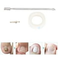thumbnail image 1 of Ingrown Toenail Tools Kit, Stainless Steel Ingrown Toenail File And Lifter Double Sided Ingrown Toenail Care, Ingrowing Nail Corrector Paronychia Treatment Foot Care Tool, 1 of 8