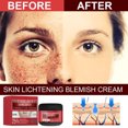 thumbnail image 3 of Crema blanqueadora de pecas Crema para pecas Crema blanqueadora hidratante para eliminar manchas oscuras, 3 of 9