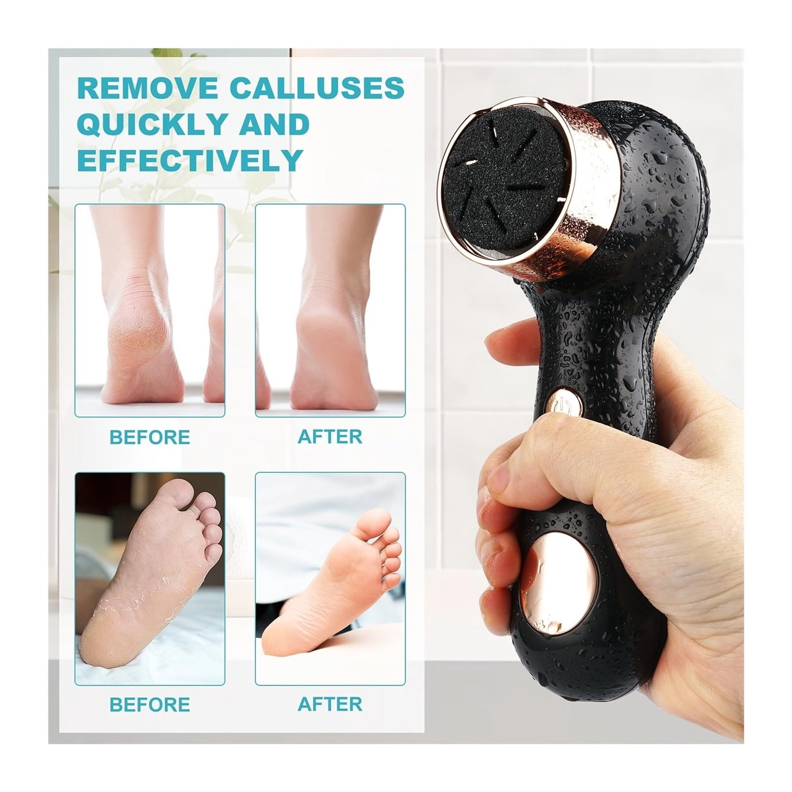 Electric Callus Remover for Feet with Vacuum, Premium Portable Pedicure Tools Rechargeable Waterproof 2 Speed Foot File Scrubber Callus Remover Tool Foot Care kit(Black)