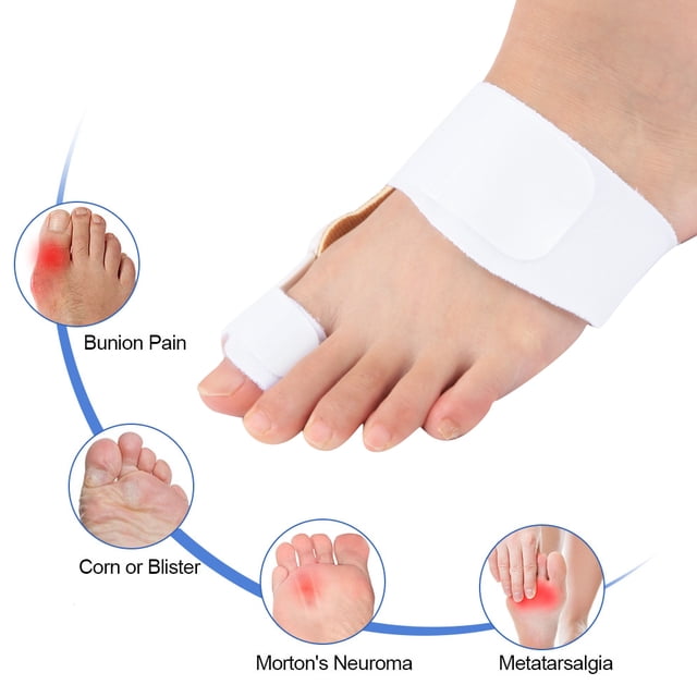 Bunion Corrector, Bursitis White/ Blue Hallux Valgus Separators, Día/ Noche en El Día a la Noche.