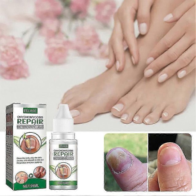 2pcs EELHOE Anti Fungal Treatment Fungus Effective Finger Toe Nail Repair Liquid Solution