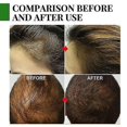 thumbnail image 4 of 3pcs Aceite esencial de romero orgánico para el crecimiento del cabello natural nutre el cabello, 4 of 5