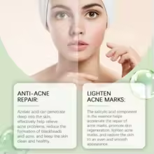 thumbnail image 3 of Suero facial con ácido salicílico EELHOE Hidratante Mejora la piel Elimina granos y puntos negros Suero para eliminar el acné con ácido azelaico, 3 of 5