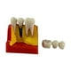 thumbnail image 1 of Modelo de dientes 4 veces, modelo de enseñanza, resina, modelo de exhibición de enseñanza de dientes para estudiantes, 1 of 9