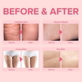 thumbnail image 4 of Crema reafirmante corporal anticelulítica Enaskin Naturals 100 ml, 4 of 7