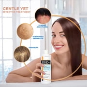 Zinc Shampoo Dhs with Seborrheic Dermatitis & Dandruff, 16 oz