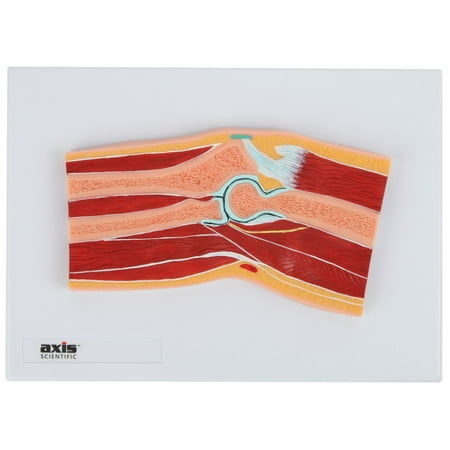 Axis Scientific Elbow Joint Cross Section Anatomy Model  Anatomical Replica of the Elbow  Includes Product Manual  Students Medical Professionals Professors Display price history on PriceWatchPro