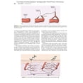 thumbnail image 3 of Local Flaps in Facial Reconstruction, 3e Baker MD, Shan R., 3 of 6