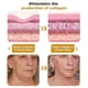 thumbnail image 4 of Bee Venom Wrinkle Removal Cream, Bee Venom Anti-wrinkle Firming Cream, Bee Venom Cream, Moisturizing, Lifting Recovery For All Skin Types, 4 of 5