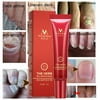 Fungal Nail Treatment Essence Nail And Foot Fungus Removal Feet Care Gel