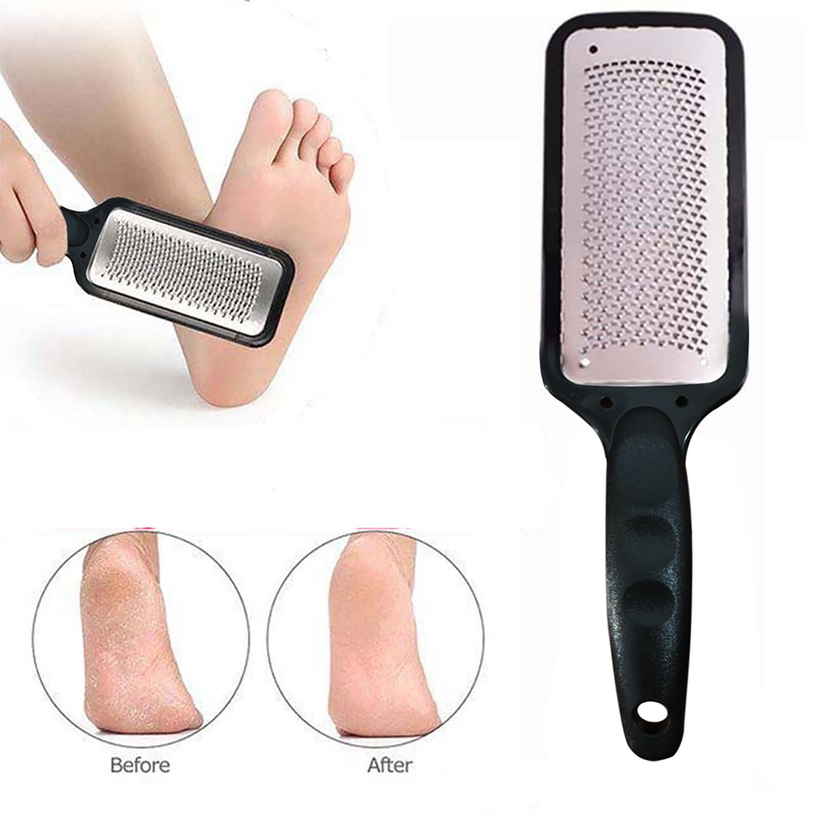 Willstar Colossal Foot Rasp Foot File and Callus Remover,Surgical Grade Stainless Steel File to Remove Hard Skin, Foot Corn, Cracked Heels,Can be Used on Both Wet and Dry Feet