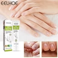 thumbnail image 1 of Gel de eliminación de hongos en las uñas ungüento antihongos para el cuidado de las uñas esencia nutritiva para el cuidado de las uñas, 1 of 9