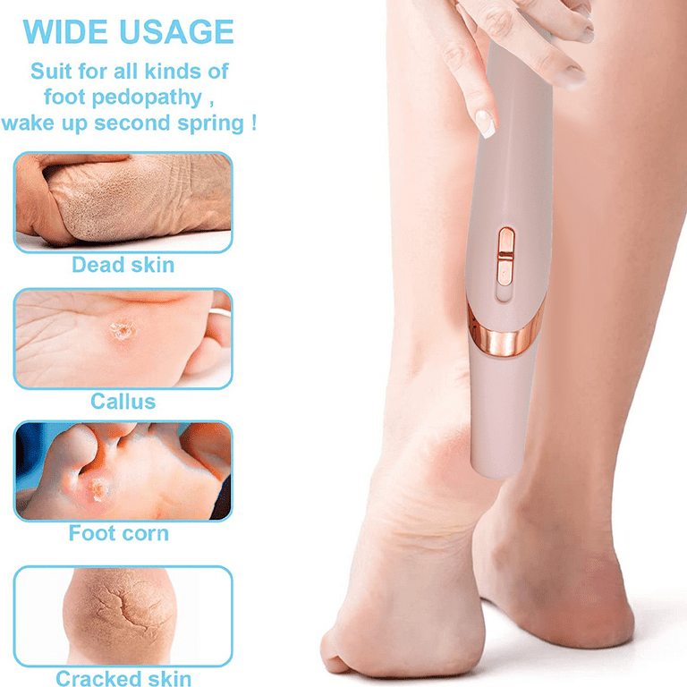 Rechargeable Electric Callus Remover Tool For An At-Home Spa Pedicure  Experience - Removes Dry Skin 