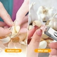 thumbnail image 2 of 6 Pcs Garlic Peelers Garlic Tweezers Garlic Peeling Tweezers Garlic Skin Remover Stainless Steel Garlic Peeler, 2 of 8