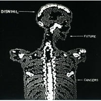 Disnihil - Future Cancers - Music & Performance - Vinyl [7-Inch]