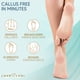 thumbnail image 5 of Removedor de callos para pies (fuerza extra) Depurador de pies Gel de callos de piel muerta - Raspador de pies de pedicura profesional Spa Essential, 6 oz, 5 of 5