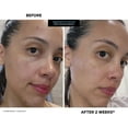 thumbnail image 3 of Kate Somerville EradiKate 3% Sulfur Daily Foaming Liquid Cleanser, 4.0 Fl Oz, 3 of 9