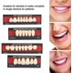 thumbnail image 4 of Dental Material Synthetic Resin False Teeth Filling Denture Tooth Care Tool Temporary Repair White Teeth Cosmetic Dentures For Upper Jaw, 4 of 5