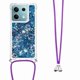 thumbnail image 1 of Funda FOXDOCK para Xiaomi Redmi Note 13 5G con Cuerda Ajustable, Brillo Líquido, Protección Antigolpes y Lente – Ideal para Regalo, 1 of 6