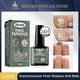 thumbnail image 2 of 15ml Fungal Nail Treatment Liquid Highly Effective Kills Toe Nail Fungus 2pcs, 2 of 5
