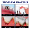 thumbnail image 4 of Pain Relief Dental Spray - Freshen Breath, Improve Oral Health, 4 of 5