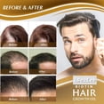 thumbnail image 5 of IBeaLee Hair Care Liquid is a strong and nutritious hair care solution that prevents hair loss, moisturizes the roots, thickens the scalp, and provides massage nutrition, 5 of 5